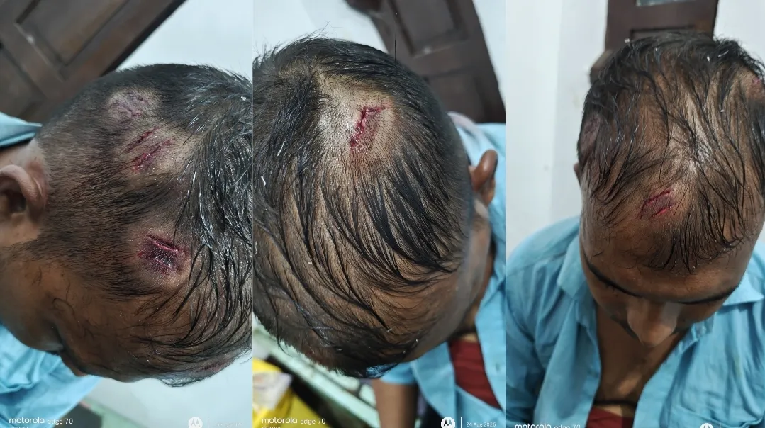 আবাসের সমীক্ষা করতে গিয়ে আক্রান্ত পঞ্চায়েত কর্মী, গ্রেফতার পুত্র সহ লাদেন